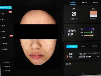 皮膚檢測(cè)儀哪家強(qiáng)?Visia、美圖宜膚、A-one實(shí)測(cè)