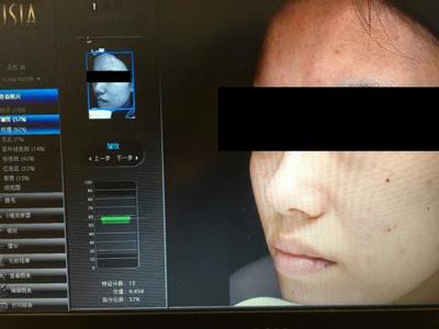 皮膚檢測(cè)儀哪家強(qiáng)？Visia、美圖宜膚、A-one實(shí)測(cè)深度對(duì)比