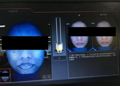 皮膚檢測(cè)儀深度實(shí)測(cè) Visia、美圖宜膚、A-one究竟哪家強(qiáng)？